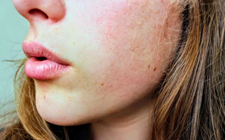 One Unexpected Way To Reduce Inflammation Heal Your Skin